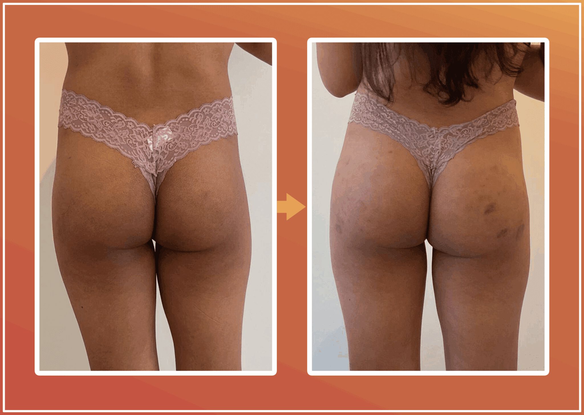 Bilvergroting resultaat