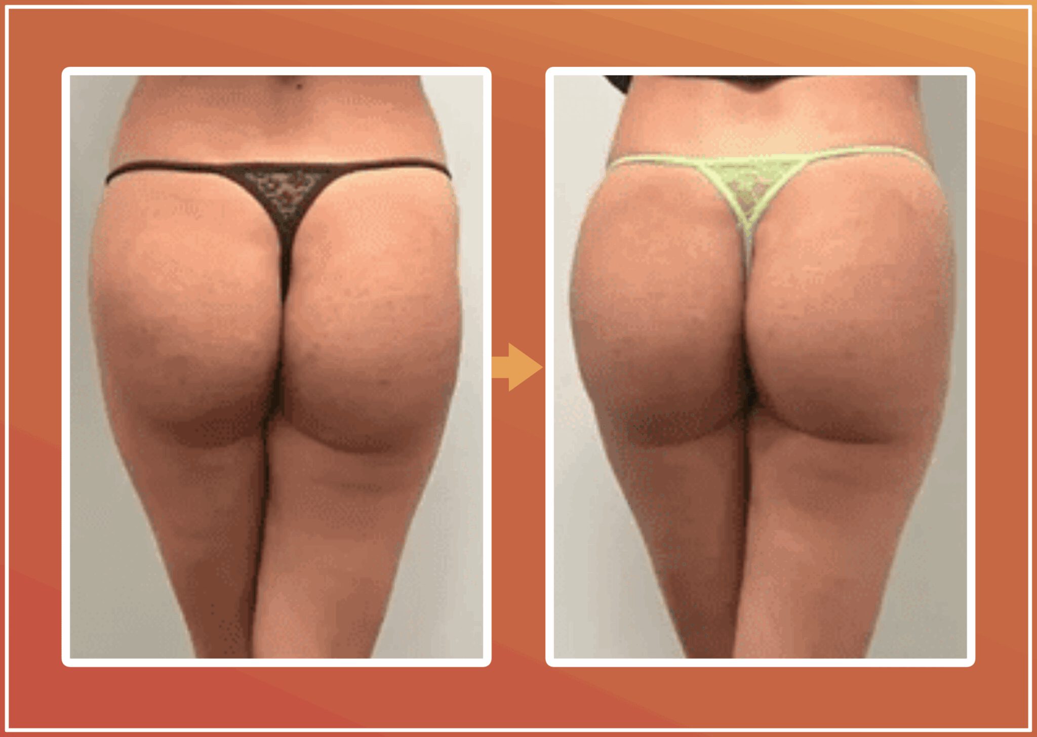 Bilvergroting resultaat