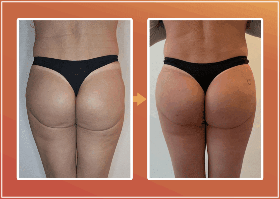 Bilvergroting resultaat